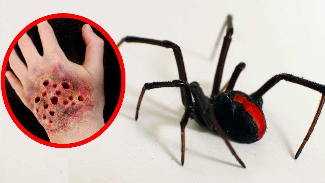 Насколько опасен укус рыжего муравья