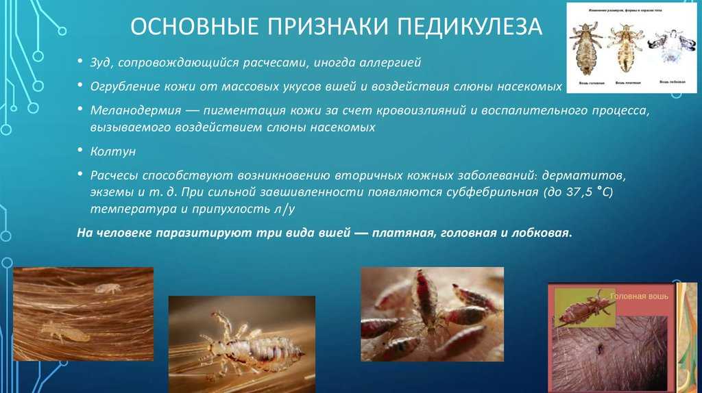 Педикулез * клиника диана в санкт-петербурге