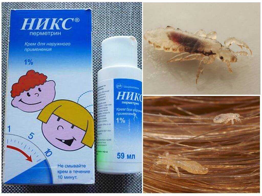 Блохи у кур: симптомы заражения, как избавиться