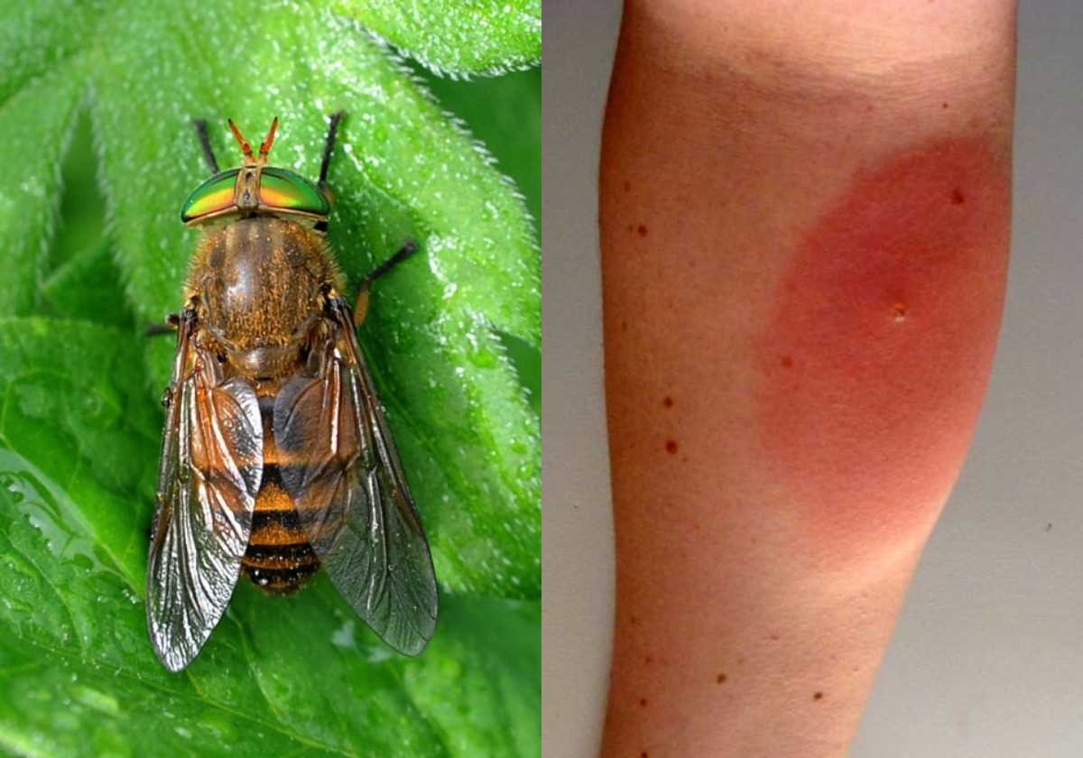 Какие мухи кусаются и чем их укусы опасны для человека Почему в августе мухи становятся кусачими Чем лечить повреждения от укуса мухи