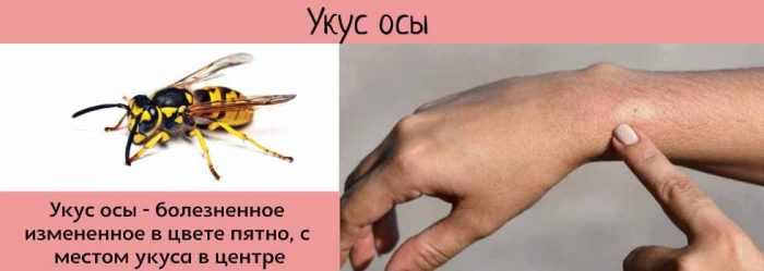 Укус осы картинки