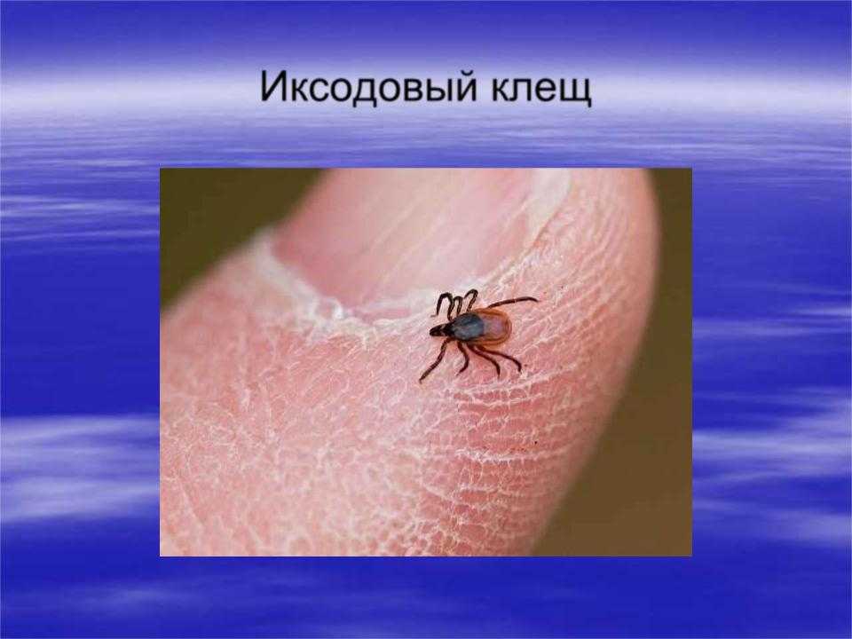 Может ли клещ сам отвалиться у человека