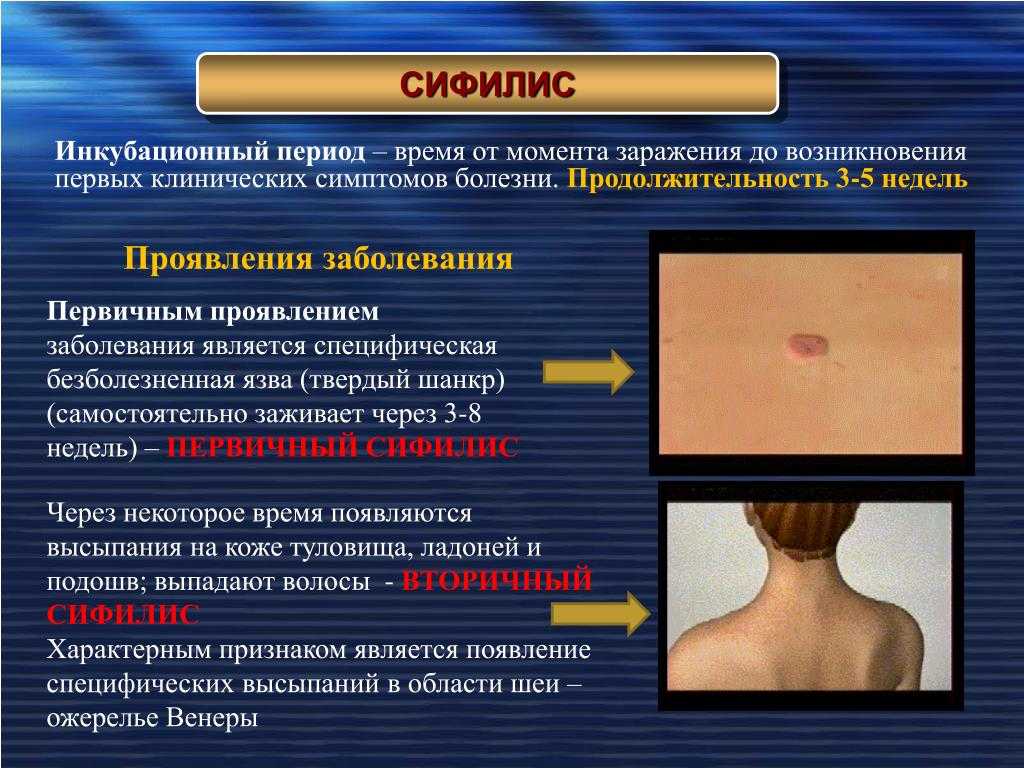 Сыпь аллергическая карта вызова