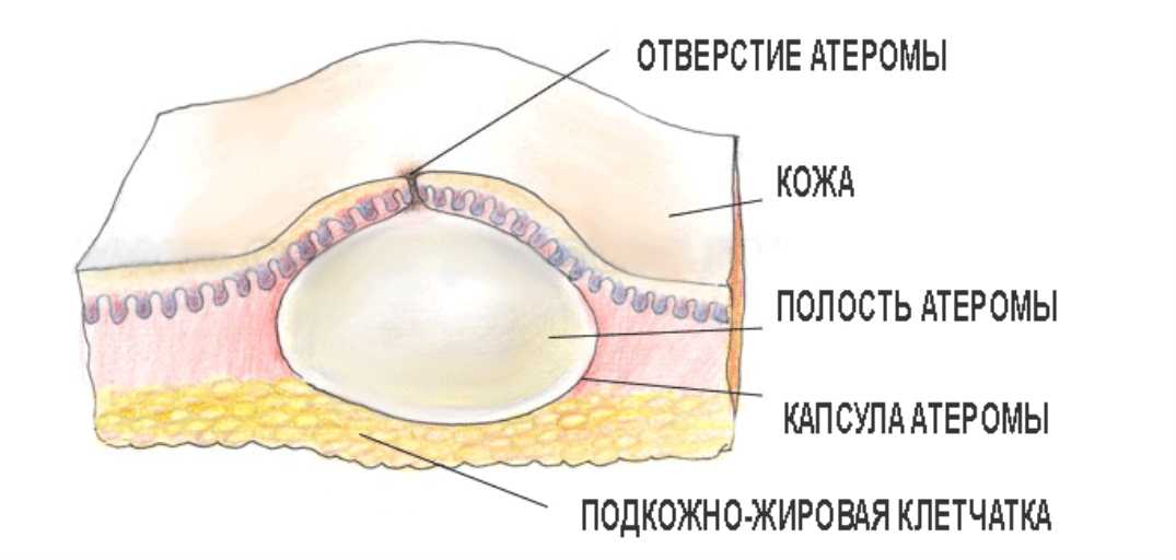 Ясеневая шпанка: описание и образ жизни жука-нарывника