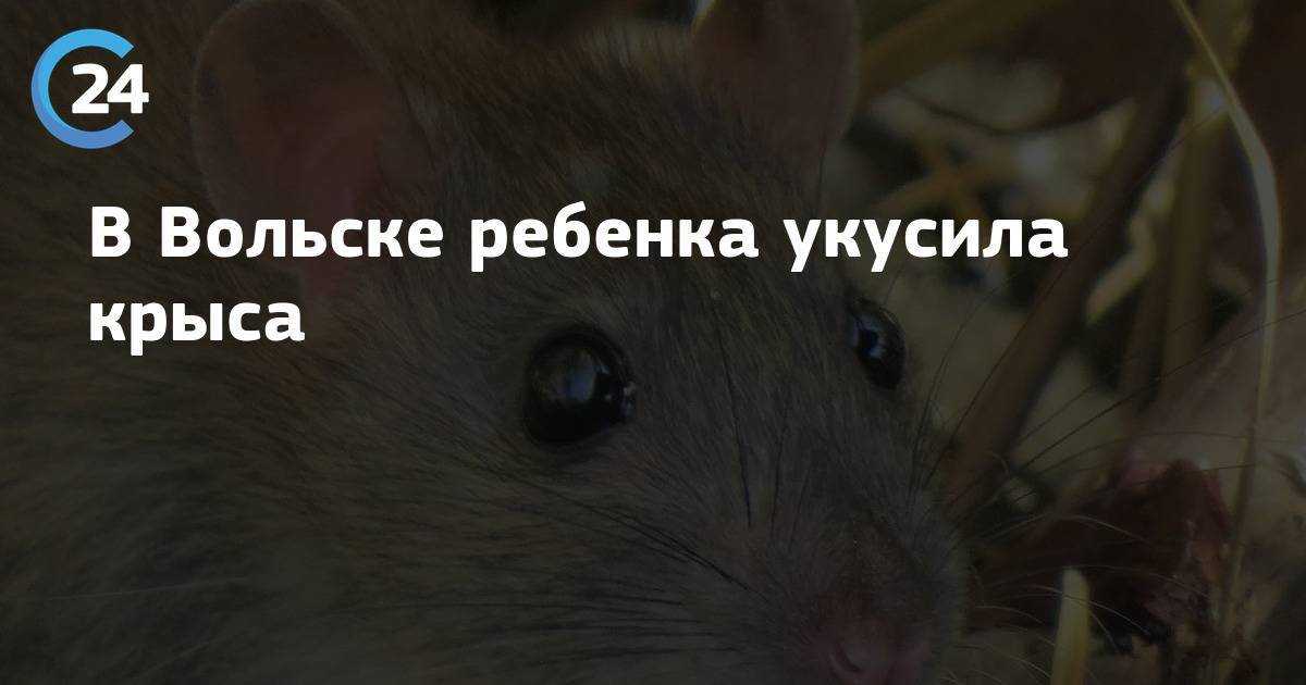 Укусила крыса ‒ что делать и чем это грозит?