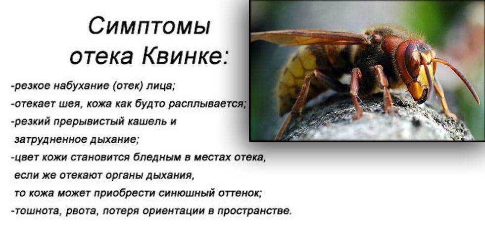 Укус шершня и его последствия, фото раны: что будет, если укусит это насекомое, что делать?
