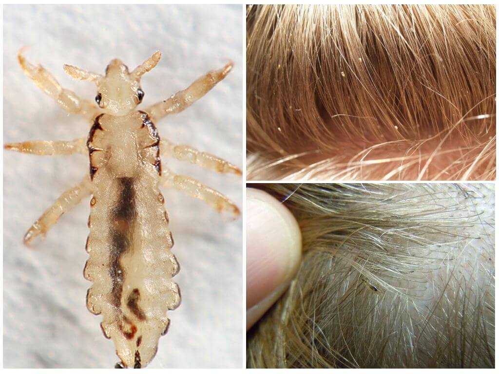 Могут ли клопы жить в волосах человека и животных