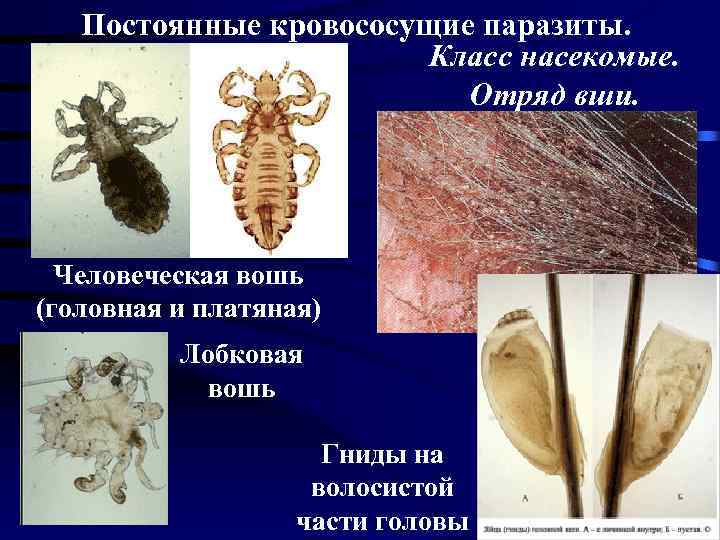 Разница между вшами и блохами - разница между - 2022