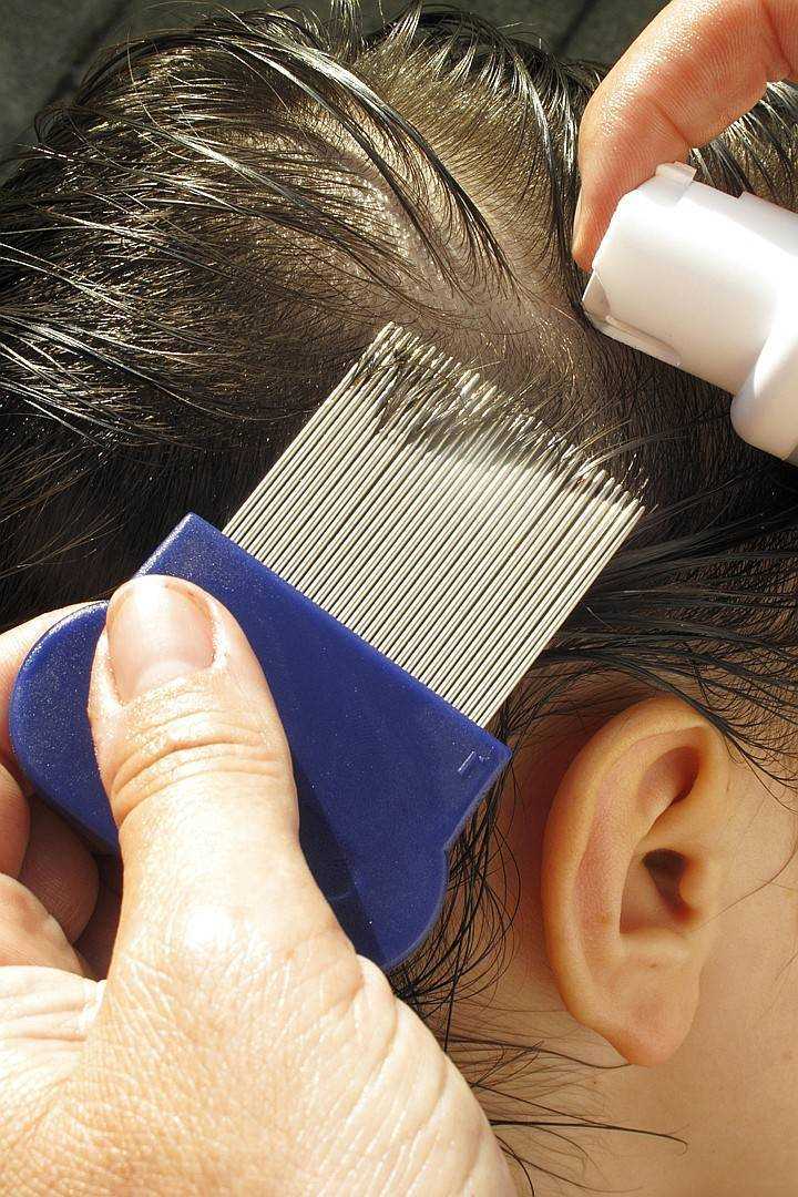 Как ухаживать за волосами что бы не появились вши