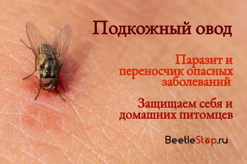 Глистная инвазия (глисты): симптомы и лечение