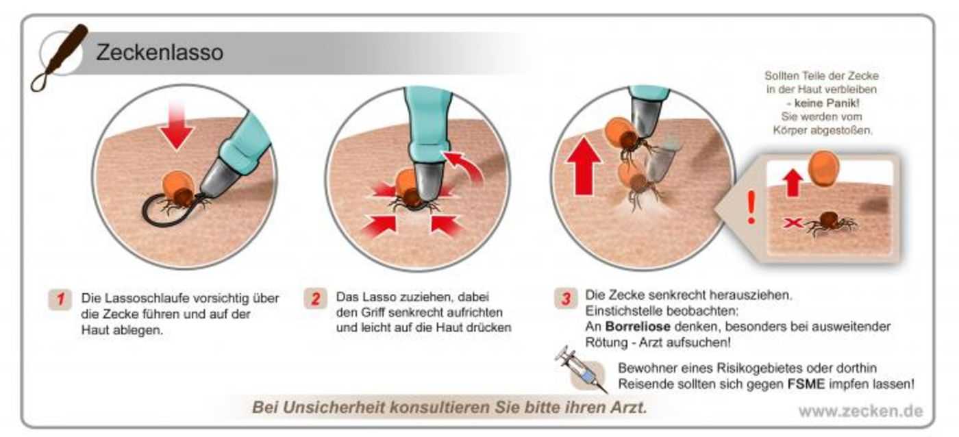 Gegen zecken impfen ja oder nein