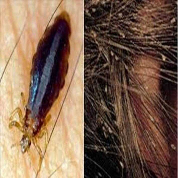 Какие паразиты могут жить в волосах человека кроме вшей