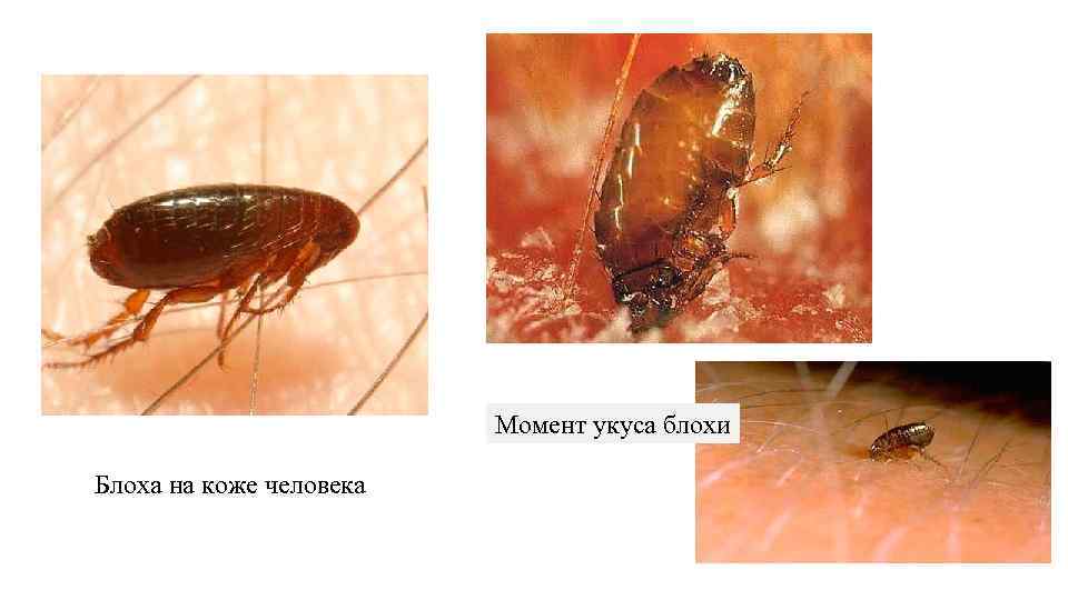 Укусы блох: как избавиться от паразитов в домашних условиях