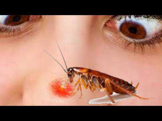 Кусаются ли тараканы и насколько сильно они вредят человеку. | parnas42.ru