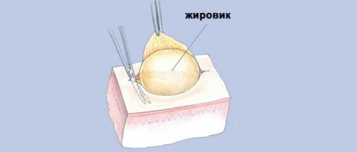 6 самых опасных насекомых юга россии