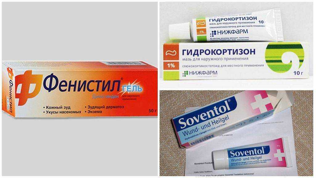 Аллергия на насекомых - симптомы, причины, профилактика и лечение