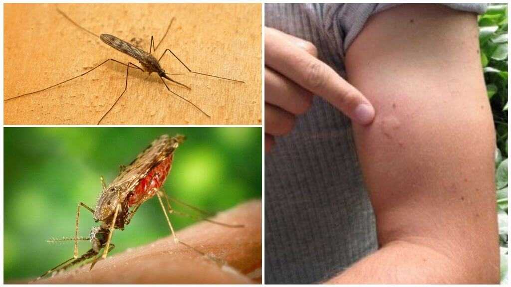 Картинки как кусают комары