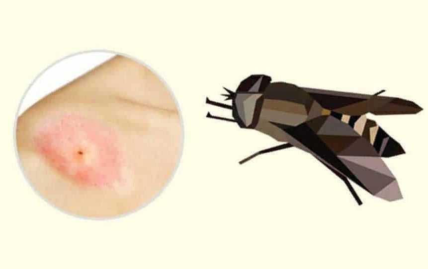 Почему мухи начинают кусаться в августе. почему мухи осенью кусаются