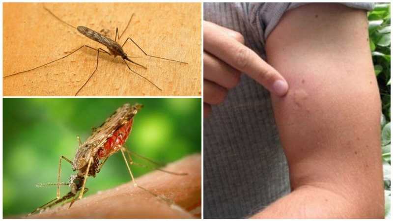 Как отличить малярийных комаров от обычных и как выглядит их укус Симптомы укуса и его последствия Что делать при укусе и как его предотвратить