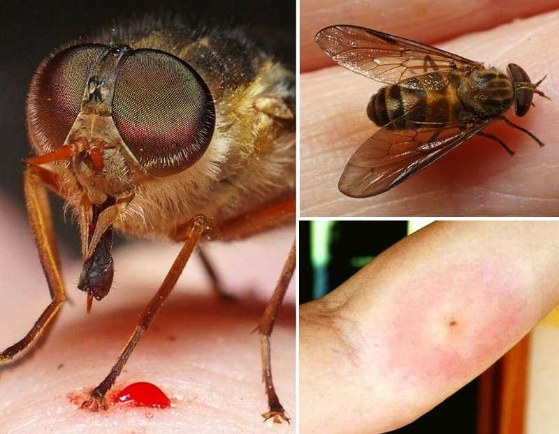 Какая муха меня укусила: как распознать укусы насекомых на даче и что предпринять